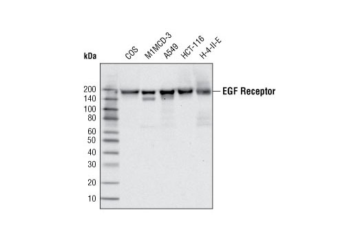Western Blotting Image 1: EGF Receptor (C74B9) Rabbit mAb