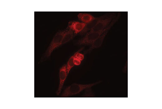 Immunofluorescence Image 1: VCP Antibody