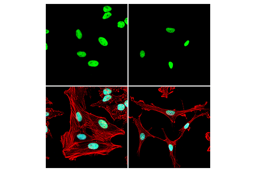 Immunofluorescence Image 1: Ubiquityl-Histone H2A (Lys119) (D27C4) XP® Rabbit mAb (Alexa Fluor® 488 Conjugate)