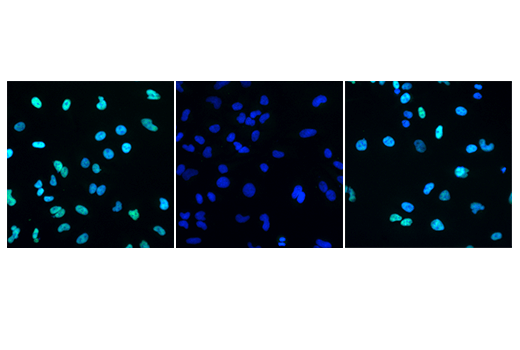 Immunofluorescence Image 2: Ubiquityl-Histone H2A (Lys119) (D27C4) XP® Rabbit mAb (Alexa Fluor® 488 Conjugate)