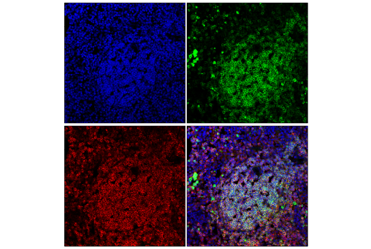 Immunofluorescence Image 2: SHP-1 (E1U6R) Rabbit mAb