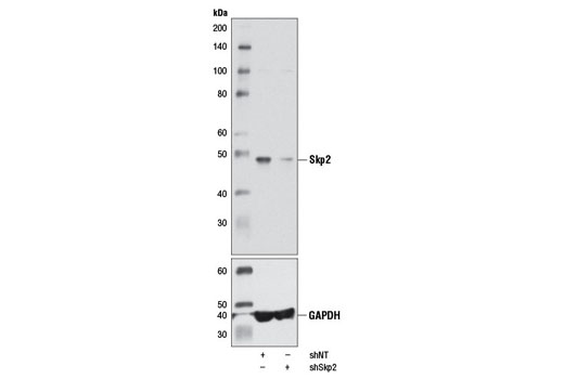  Image 18: Ubiquitin E3 Ligase Complex Antibody Sampler Kit