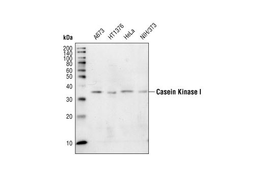 Western Blotting Image 1: CK1 Antibody