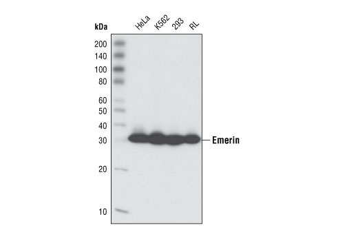 Western Blotting Image 1: Emerin (L12) Antibody
