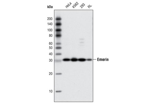 Western Blotting Image 1: Emerin (A212) Antibody