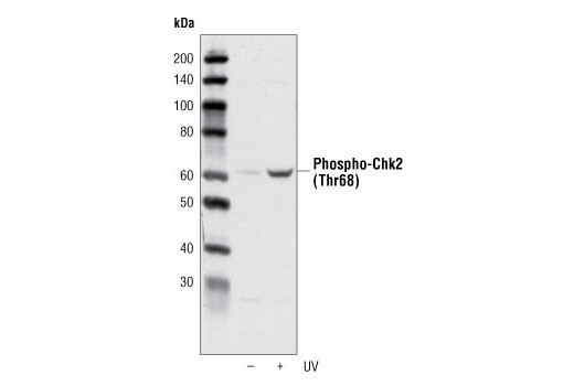 Western Blotting Image 1: Phospho-Chk2 (Thr68) Antibody
