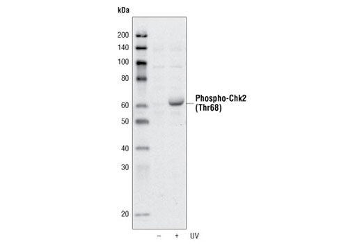 Western Blotting Image 2: Phospho-Chk2 (Thr68) Antibody