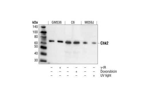 Western Blotting Image 1: Chk2 Antibody