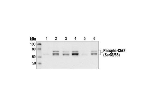 Western Blotting Image 1: Phospho-Chk2 (Ser33/35) Antibody
