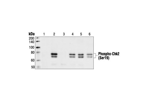  Image 7: Phospho-Chk1/2 Antibody Sampler Kit