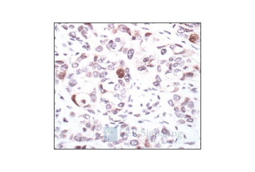  Image 21: Phospho-Chk1/2 Antibody Sampler Kit