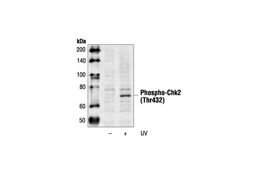 Western Blotting Image 1: Phospho-Chk2 (Thr432) Antibody