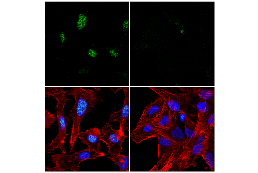 Immunofluorescence Image 1: CASC5 (E4A5L) Rabbit mAb