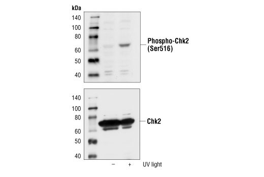 Western Blotting Image 1: Phospho-Chk2 (Ser516) Antibody