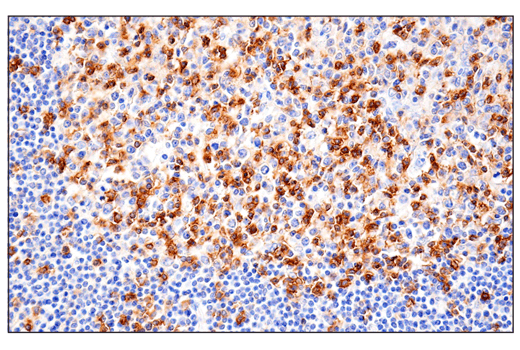 Immunohistochemistry Image 1: CD11α (E5S9K) Rabbit mAb