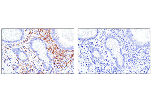 Immunohistochemistry Image 2: CD11α (E5S9K) Rabbit mAb