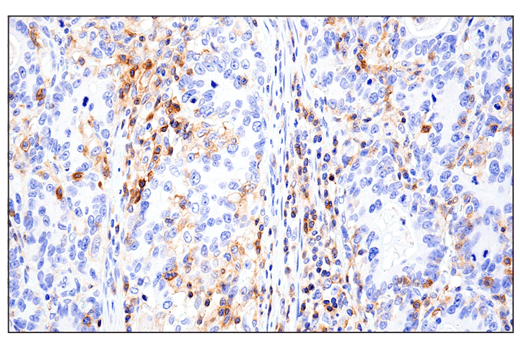 Immunohistochemistry Image 5: CD11α (E5S9K) Rabbit mAb