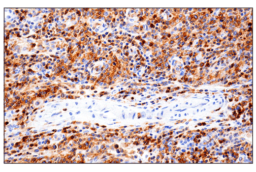 Immunohistochemistry Image 8: CD11α (E5S9K) Rabbit mAb (BSA and Azide Free)