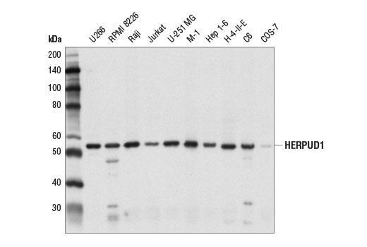 Western Blotting Image 1: HERPUD1 Antibody