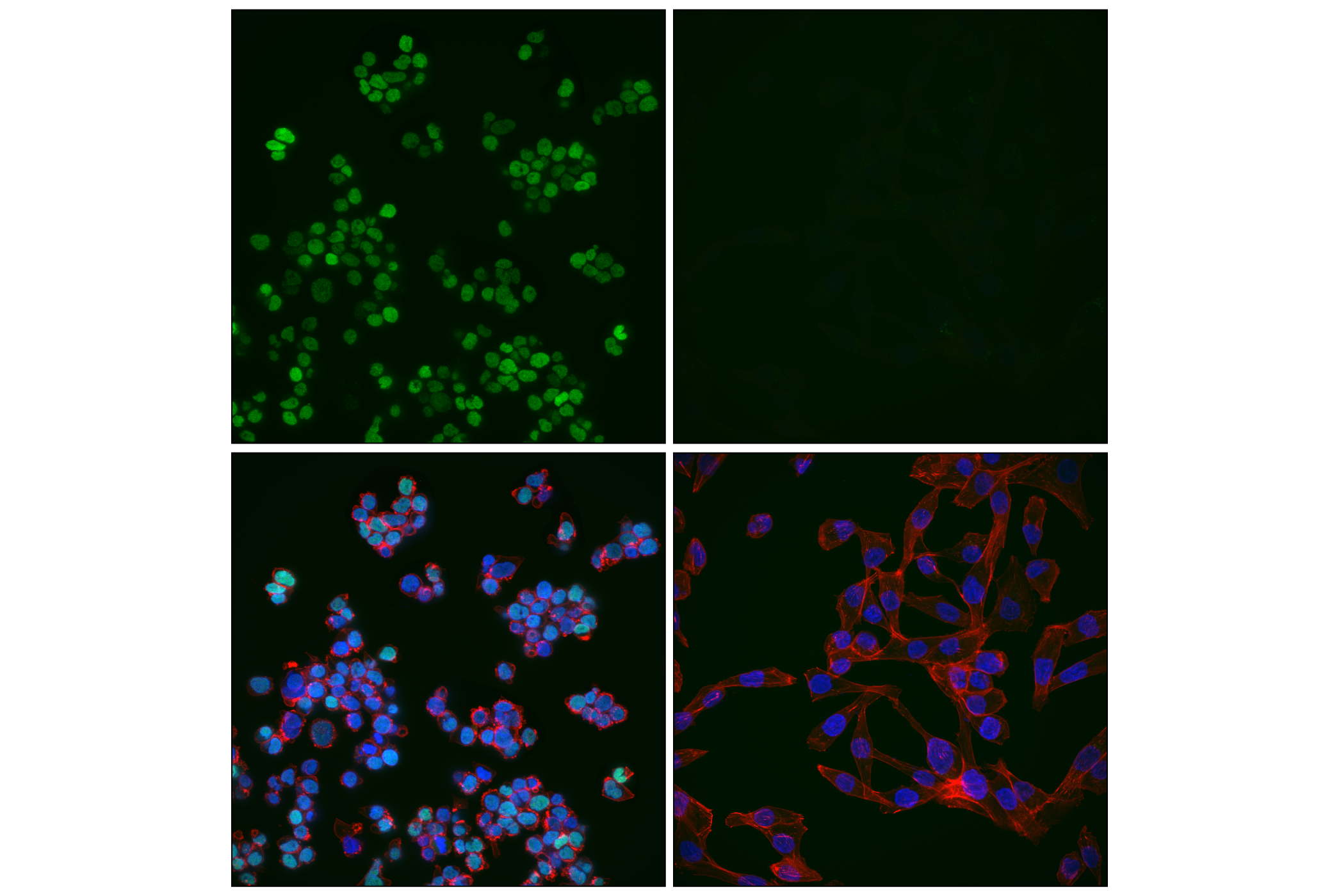 Immunofluorescence Image 1: c-Maf (E2Q5D) Rabbit mAb