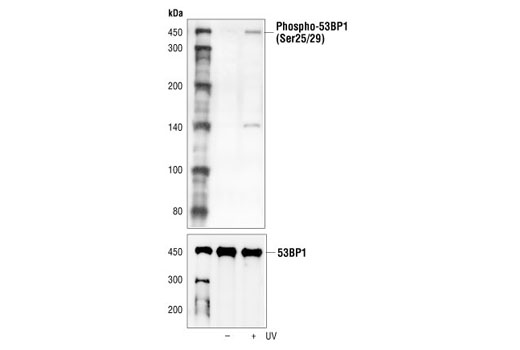Western Blotting Image 1: Phospho-53BP1 (Ser25/29) Antibody