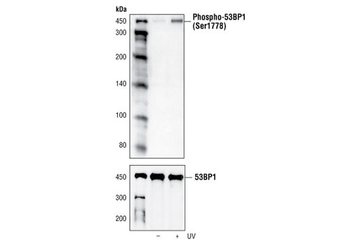 Western Blotting Image 1: Phospho-53BP1 (Ser1778) Antibody