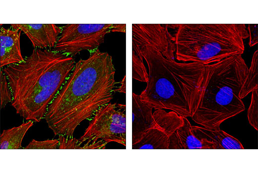 Immunofluorescence Image 1: β-Catenin (L54E2) Mouse mAb