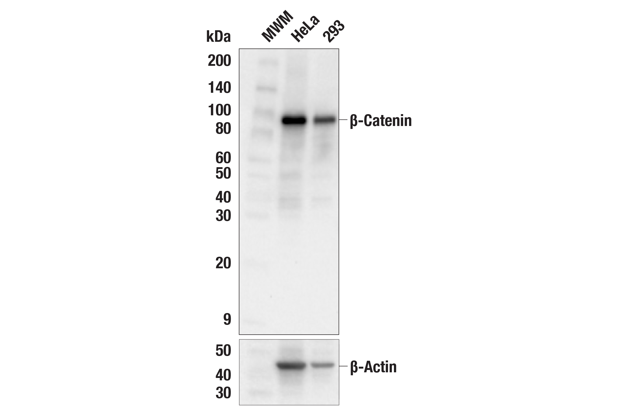 Western Blotting Image 1: β-Catenin (L54E2) Mouse mAb