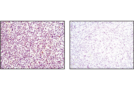 Immunohistochemistry Image 2: p35/25 (C64B10) Rabbit mAb