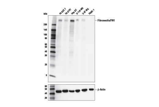 Western Blotting Image 1: Fibronectin/FN1 (E5H6X) Rabbit mAb