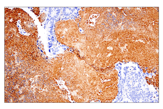 Immunohistochemistry Image 3: Fibronectin/FN1 (E5H6X) Rabbit mAb