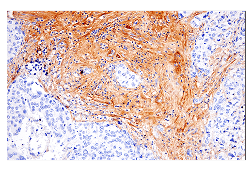 Immunohistochemistry Image 4: Fibronectin/FN1 (E5H6X) Rabbit mAb