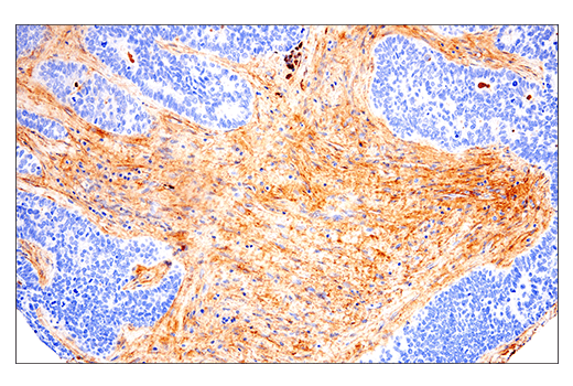 Immunohistochemistry Image 7: Fibronectin/FN1 (E5H6X) Rabbit mAb