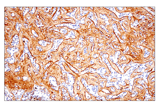 Immunohistochemistry Image 8: Fibronectin/FN1 (E5H6X) Rabbit mAb