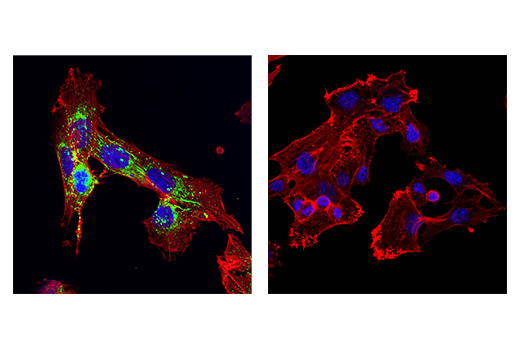 Immunofluorescence Image 1: Fibronectin/FN1 (E5H6X) Rabbit mAb