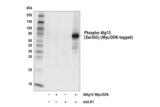  Image 3: ULK1 Substrate Antibody Sampler Kit
