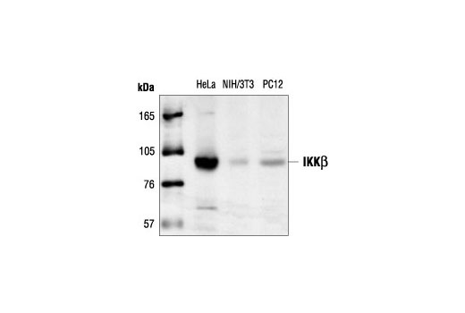 Western Blotting Image 1: IKKβ Antibody