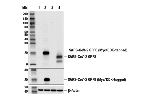 Western Blotting Image 1: SARS-CoV-2 ORF8 (E6H7V) Rabbit mAb