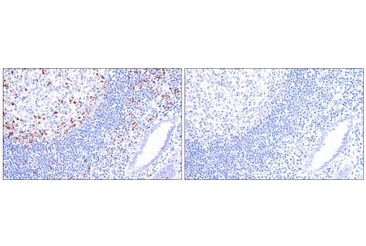 Immunohistochemistry Image 13: CTLA-4 (E2V1Z) Rabbit mAb (BSA and Azide Free)