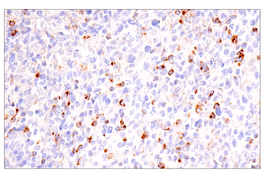 Immunohistochemistry Image 5: CTLA-4 (E2V1Z) Rabbit mAb (BSA and Azide Free)