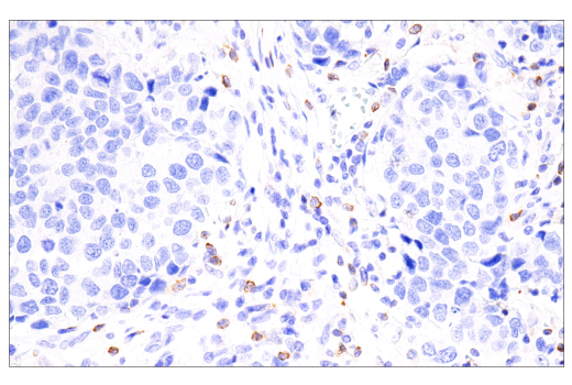 Immunohistochemistry Image 3: CTLA-4 (E2V1Z) Rabbit mAb (BSA and Azide Free)