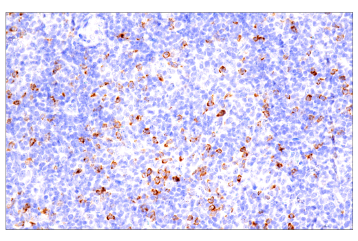 Immunohistochemistry Image 1: CTLA-4 (E2V1Z) Rabbit mAb (BSA and Azide Free)