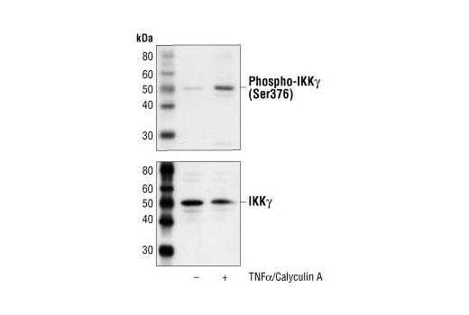Western Blotting Image 1: Phospho-IKKγ (Ser376) Antibody