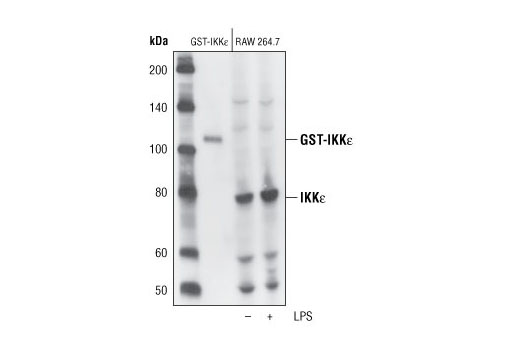  Image 2: IKK Isoform Antibody Sampler Kit