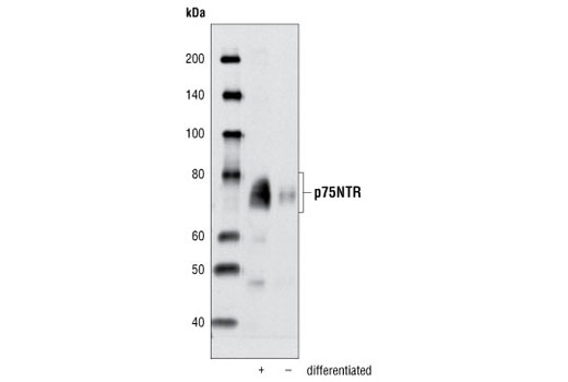 Western Blotting Image 1: p75NTR Antibody