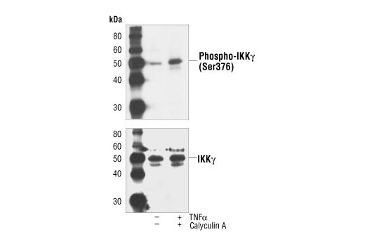  Image 3: IKK Isoform Antibody Sampler Kit