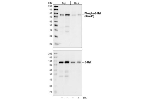 Western Blotting Image 1: Phospho-B-Raf (Ser445) Antibody