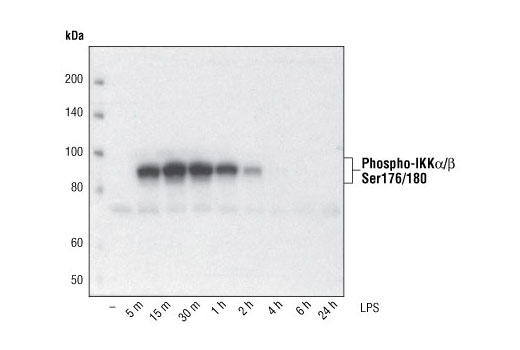  Image 3: Phospho-IKKα/β (Ser176/180) Antibody Sampler Kit