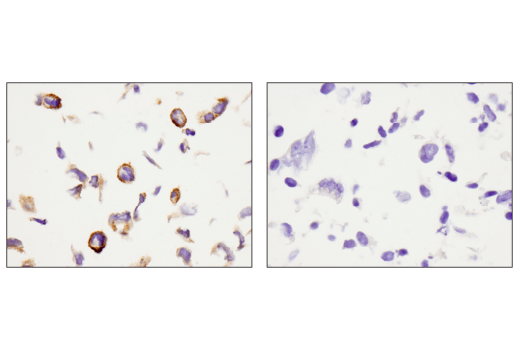 Immunohistochemistry Image 1: Podoplanin (LpMab-12) Mouse mAb