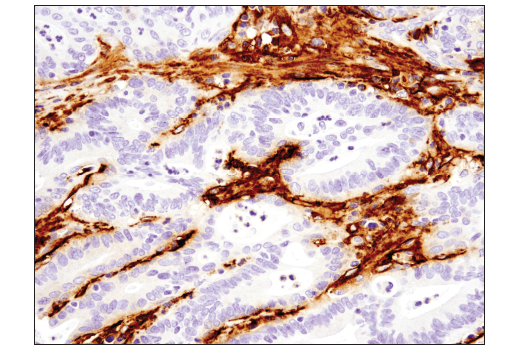 Immunohistochemistry Image 2: Podoplanin (LpMab-12) Mouse mAb